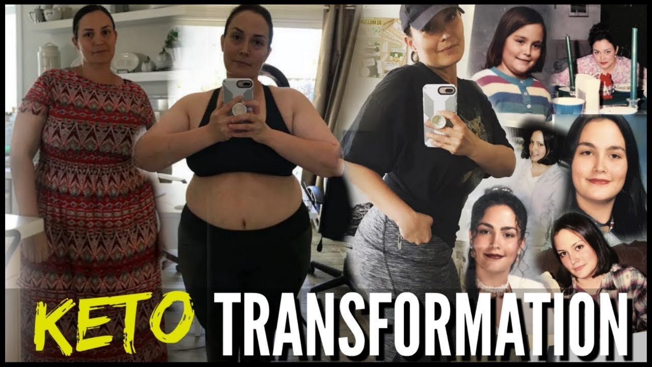 Keto Diet Before And After 1 Month
 MY KETO STORY KETO TRANSFORMATION KETO DIET BEFORE AND