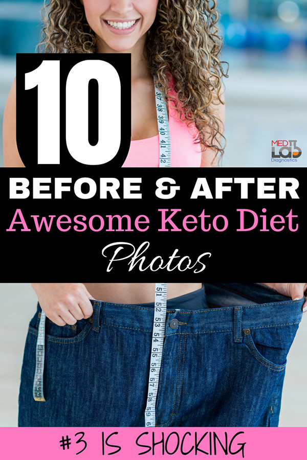 Keto Diet Before And After Food
 10 Awesome Keto Diet Before and After s