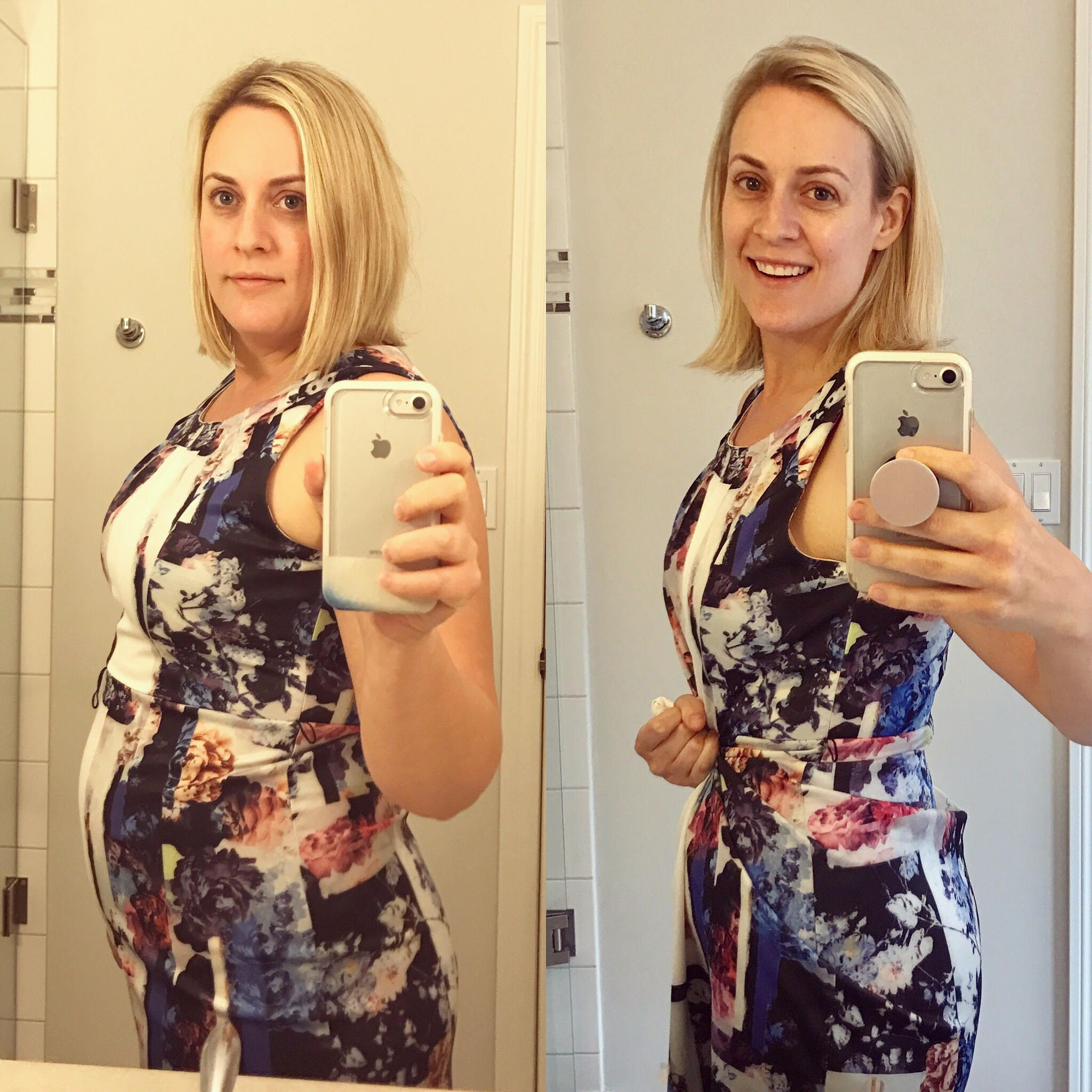 Keto Diet Before And After Food
 Pin on keto