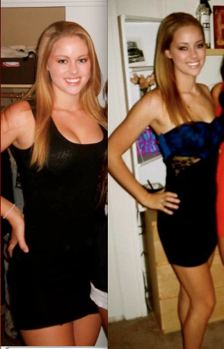 Keto Diet Before And After Pictures To Lose Weight
 Before After Keto