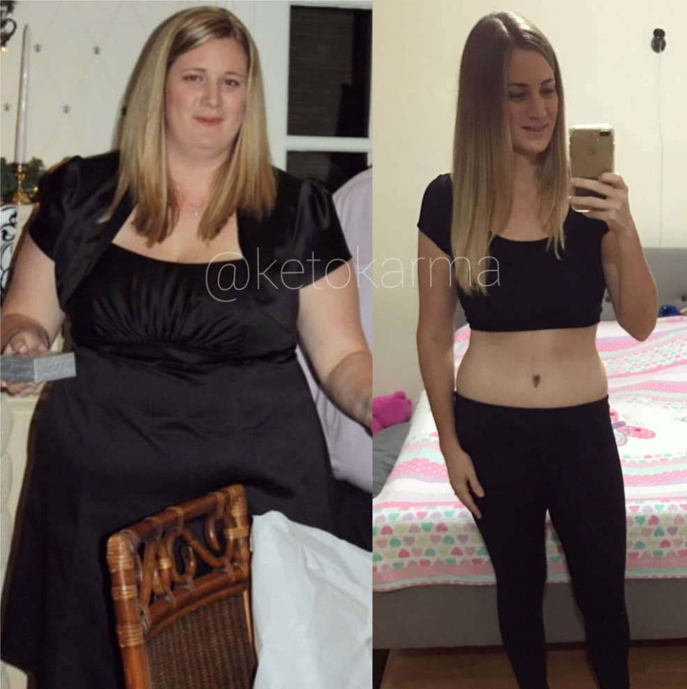 Keto Diet Before And After Pictures To Lose Weight
 Weight Loss Transformation How I Lost 100 Pounds on Keto