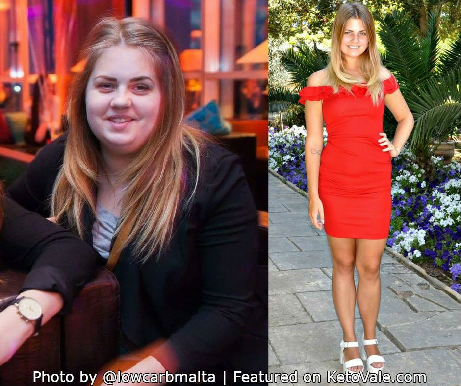 Keto Diet Before And After Success Story
 Pin en Weight Loss Motivation
