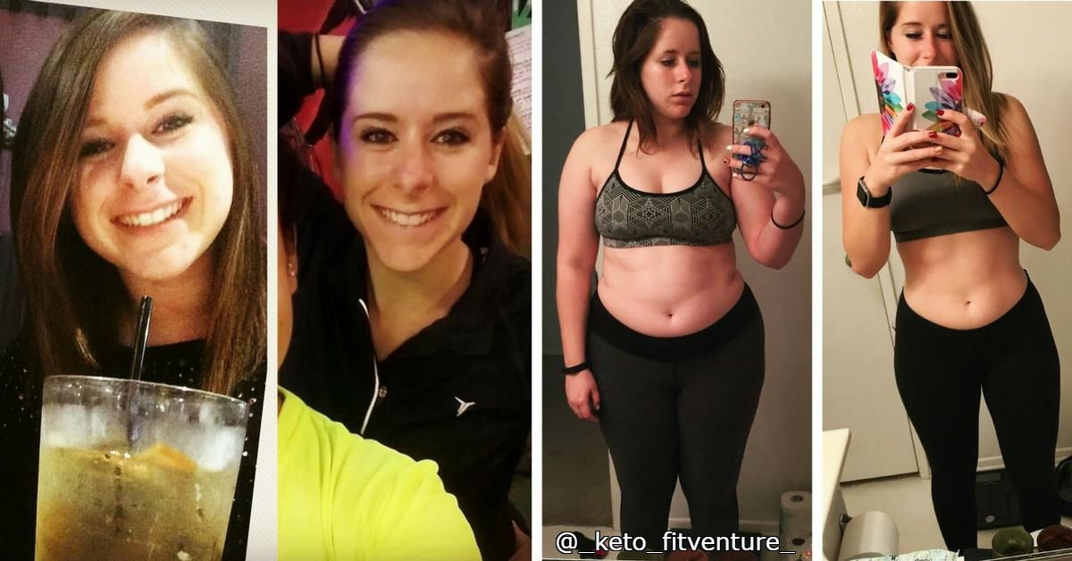 Keto Diet Before And After Success Story
 Pin on KETO