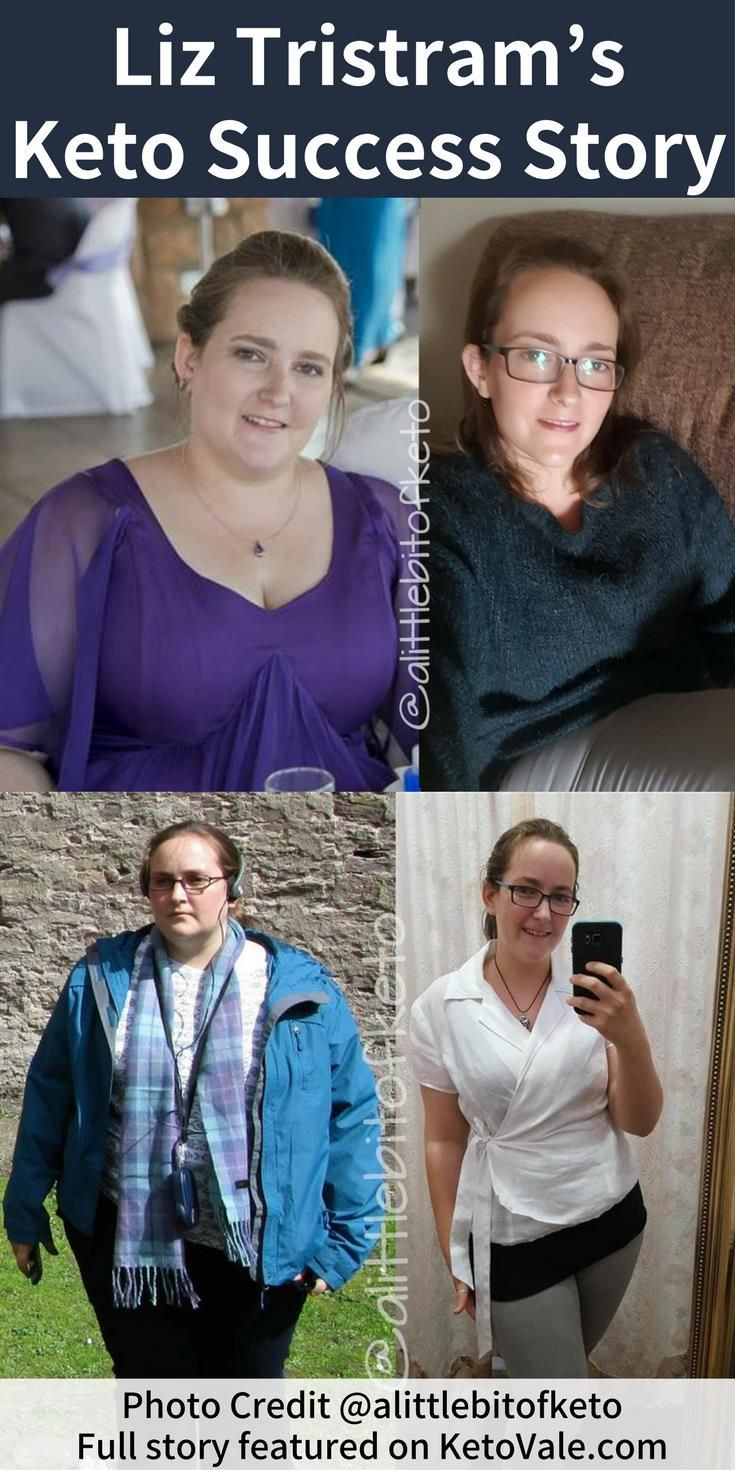 Keto Diet Before And After Success Story
 Pin on Quotes