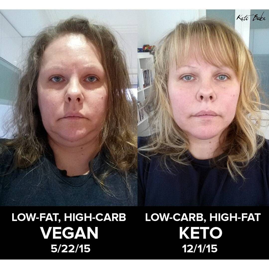 Vegan Keto Before And After
 Pin on Keto Babe on a Ketogenic Diet