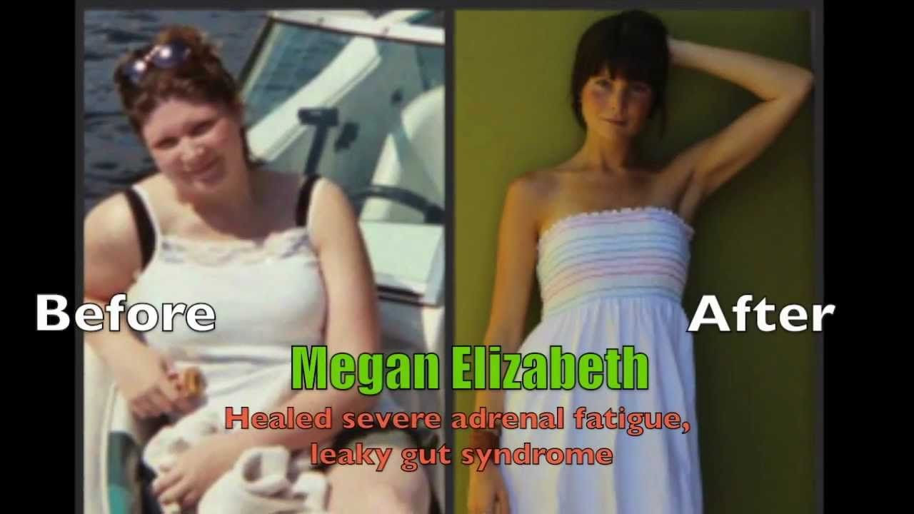 Vegan Keto Before And After
 Amazing Before and Afters Body Transformations