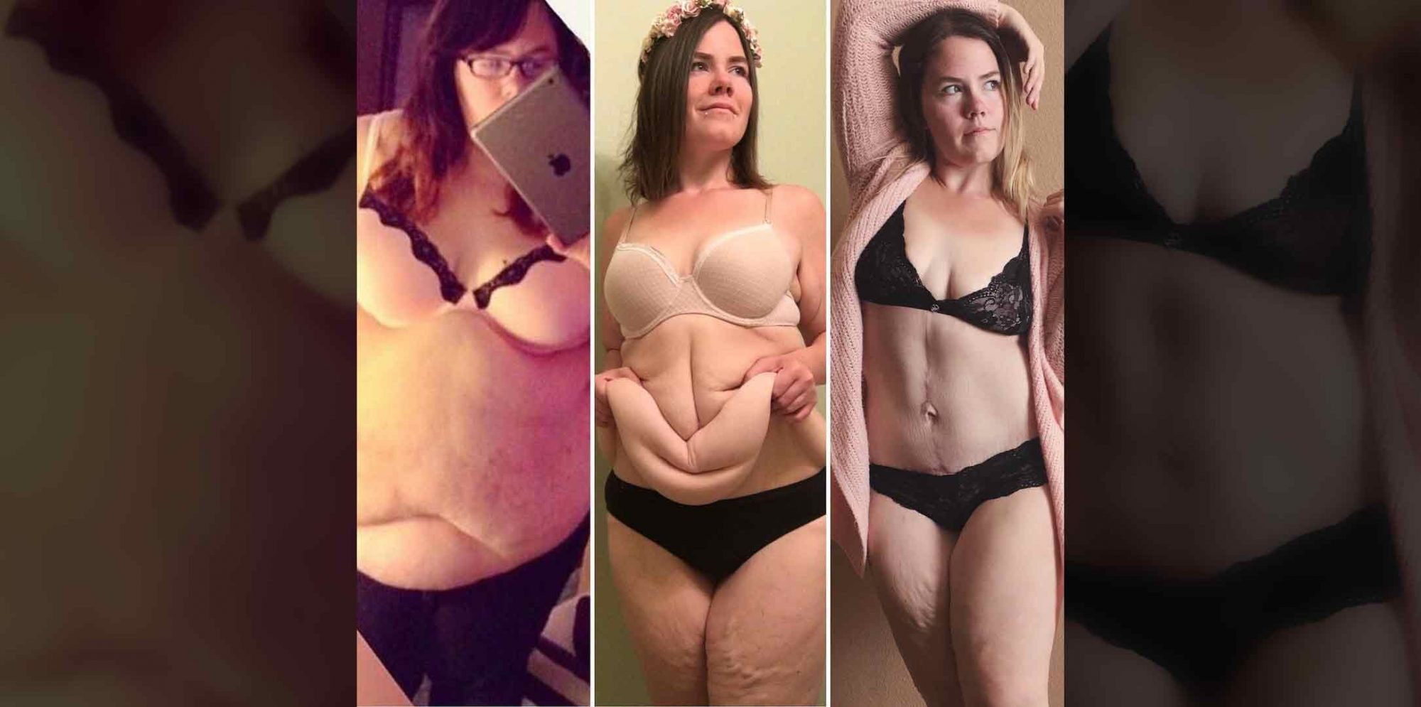 After Weight Loss Surgery
 Body Positive Instagram Star Claps Back at Critics of Her