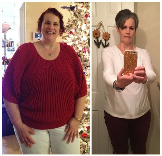 After Weight Loss Surgery
 Cheryl Loses 98lbs High BP & Cholesterol After Weight