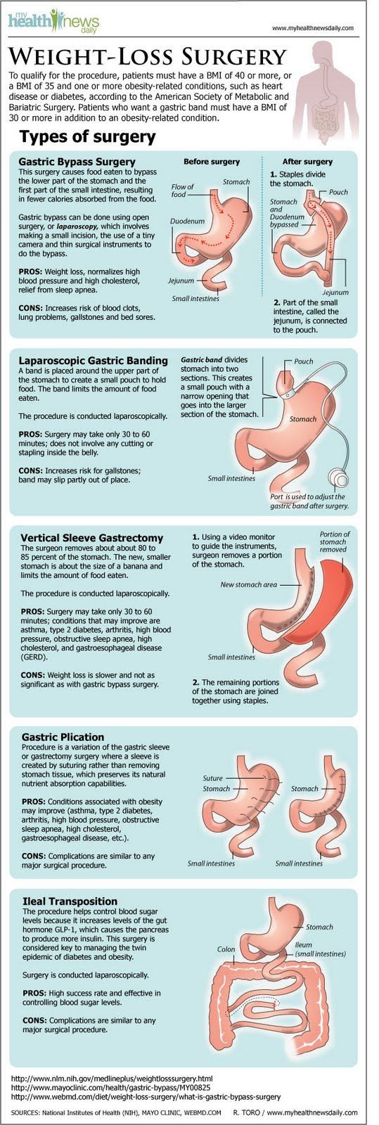 Bariatric Recipes Sleeve Weight Loss Surgery
 17 Best images about Weight Loss Surgery on Pinterest