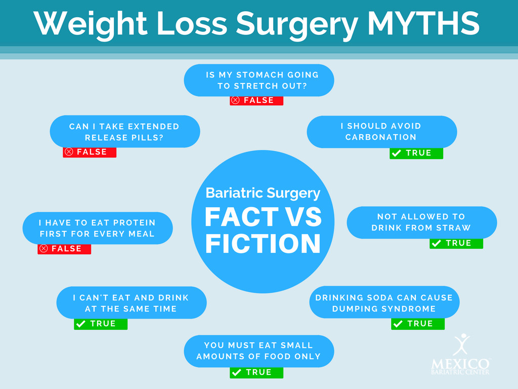 Bariatric Reset Weight Loss Surgery
 Top Bariatric Surgery Myths 8 Misconceptions of Weight