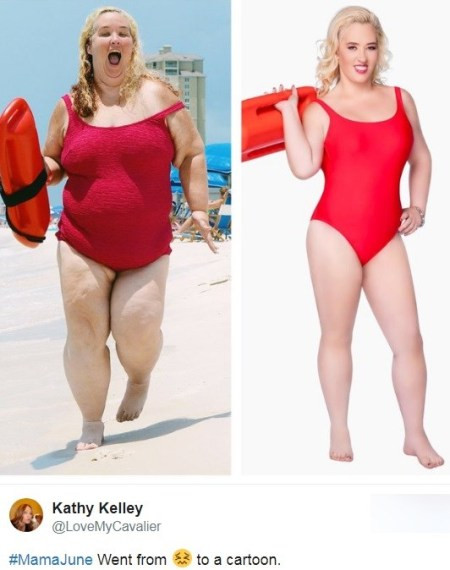 Exercise After Weight Loss Surgery
 Still skinny Mama June one year later what happened