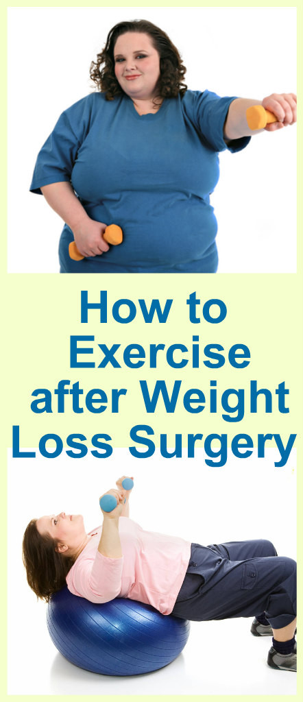 Exercise After Weight Loss Surgery
 How to Exercise After Weight Loss Surgery