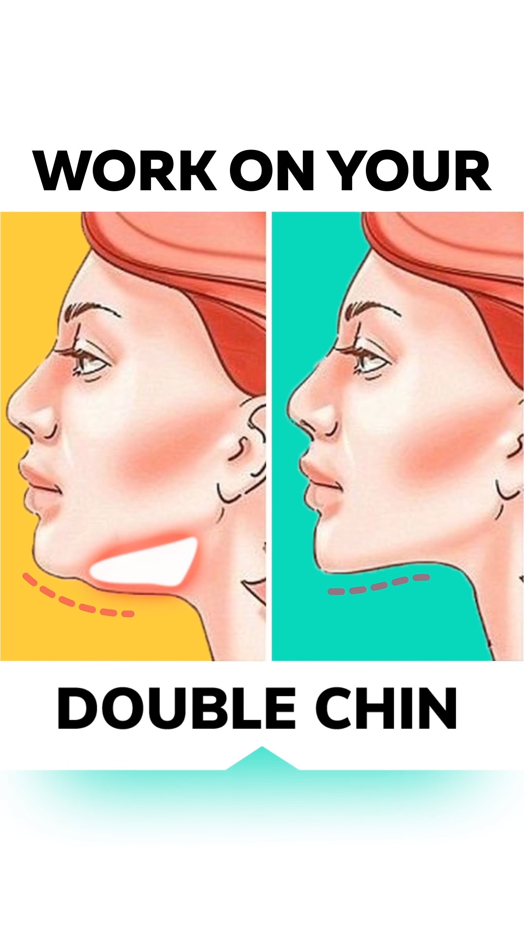 Face Weight Loss Exercises
 Pin on Lost Weight in Face