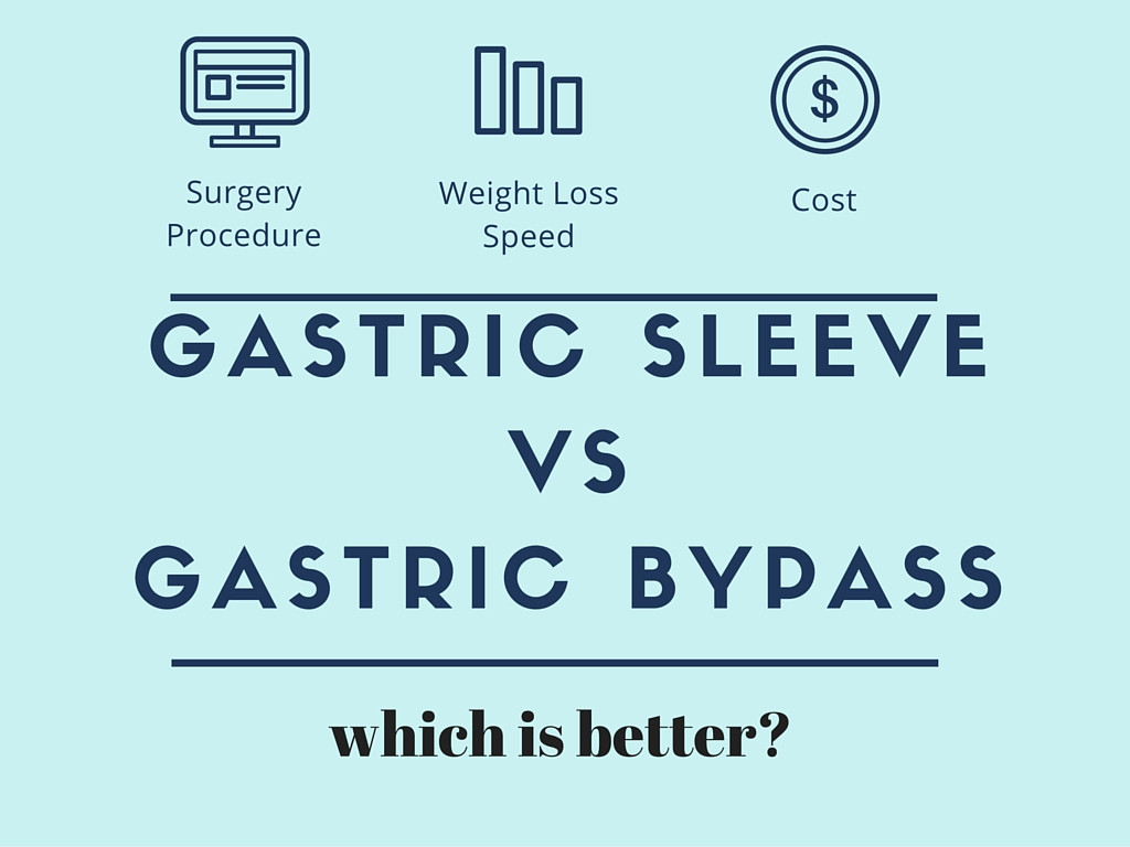 Gastric Bypass Vs Sleeve Weight Loss Surgery
 Surgery parison Gastric Sleeve VS Gastric Bypass