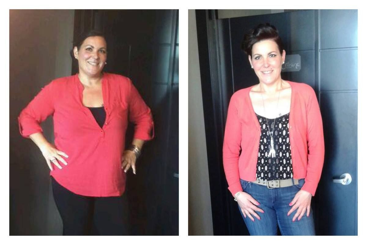 How To Dress After Weight Loss Surgery
 Pin on Before and After Weight Loss Surgery