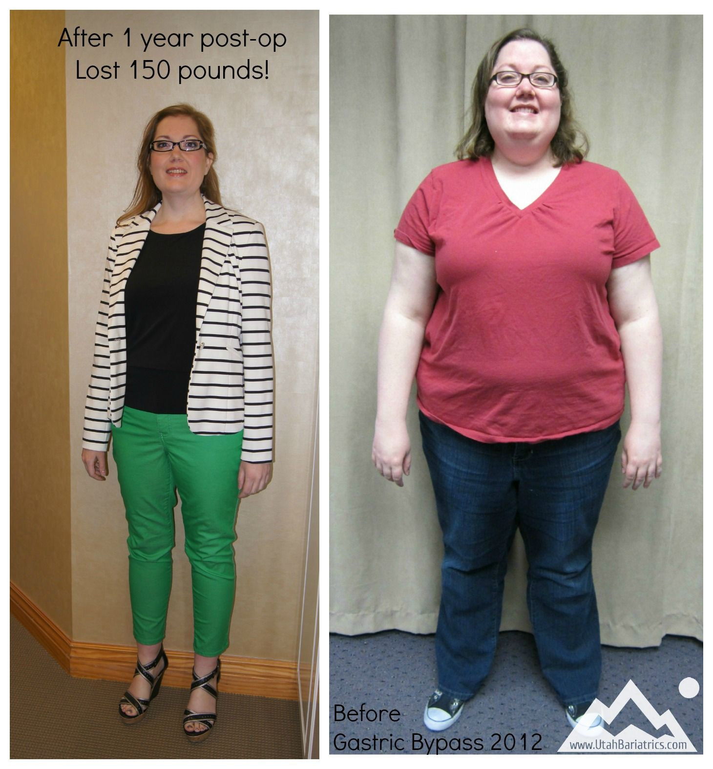 How To Dress After Weight Loss Surgery
 JESSICA LOST OVER 150 LBS AFTER GASTRIC BYPASS SURGERY