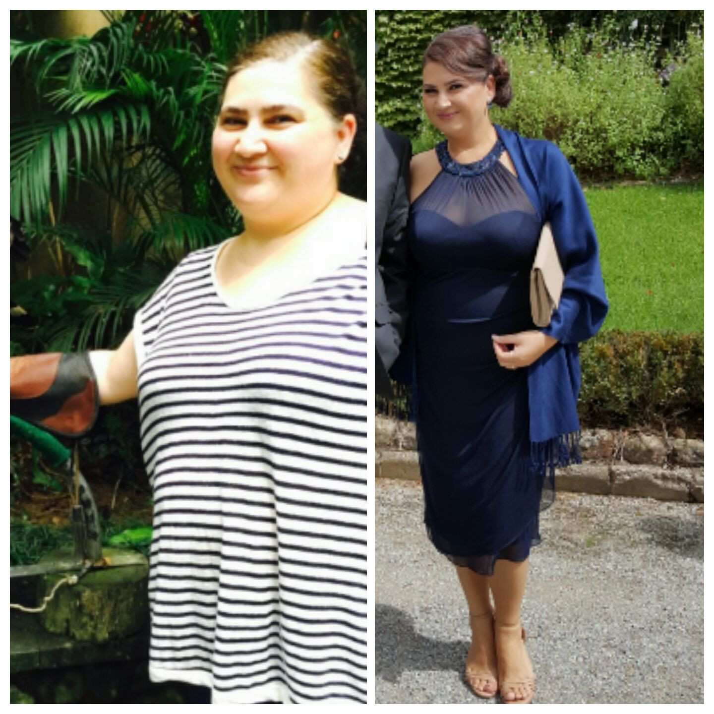 How To Dress After Weight Loss Surgery
 Pin on Weight Loss Surgery Before & After