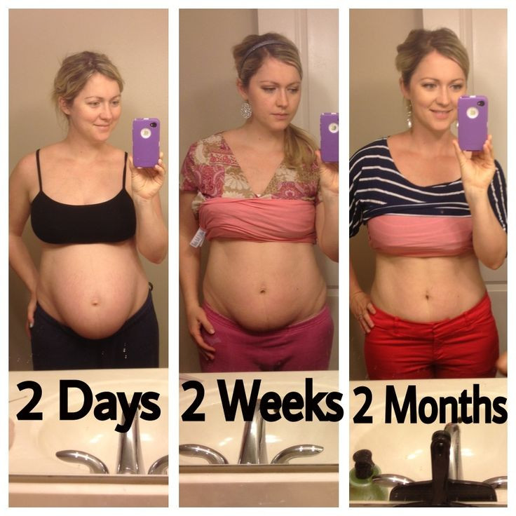 How To Lose Belly Fat After Baby
 Pin on Post Pregnancy