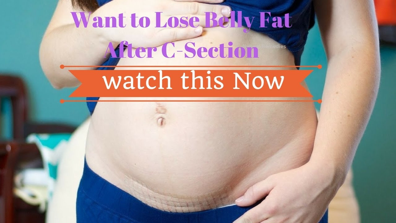 How To Lose Belly Fat After C Section
 How to Lose Belly fat After C Section NaturalReme s
