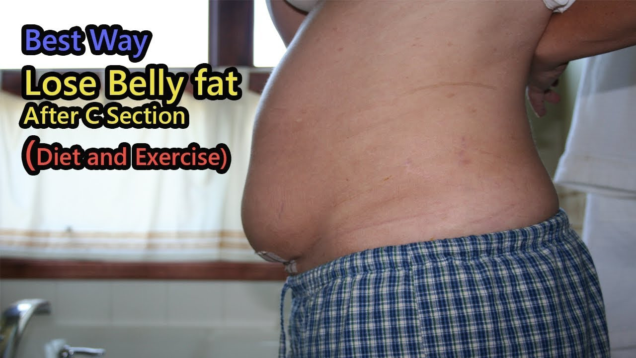 How To Lose Belly Fat After C Section
 How to Lose Belly fat After C Section Diet and Exercise