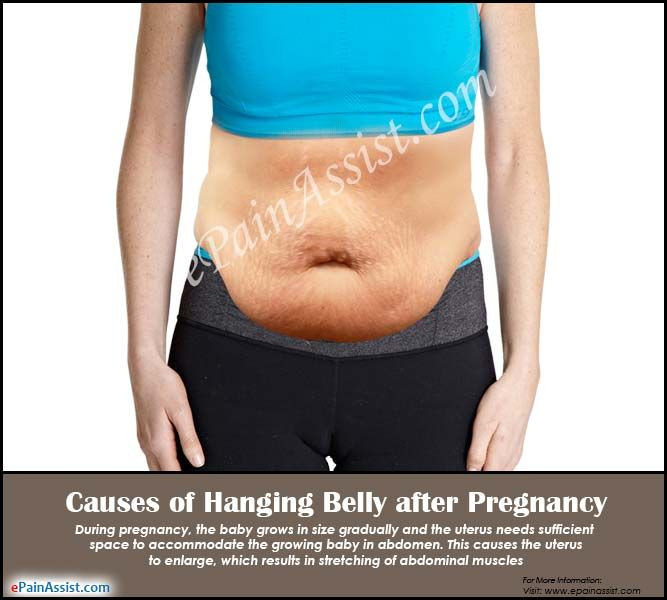 How To Lose Belly Fat After Pregnancy
 Pin on work out