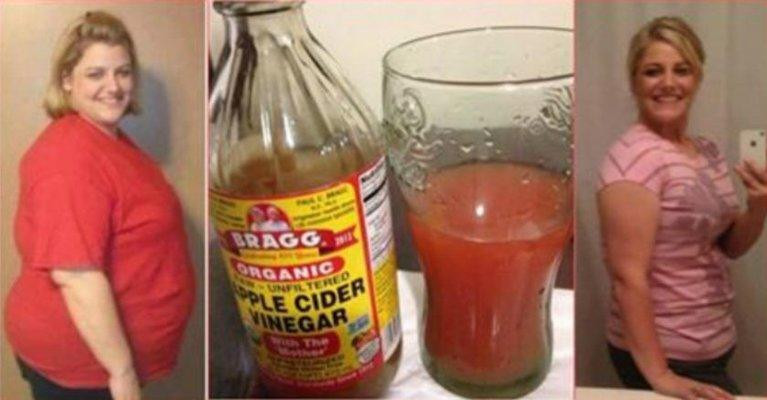 How To Lose Belly Fat With Apple Cider Vinegar
 How To Lose Stomach Fat Overnight literally with this so