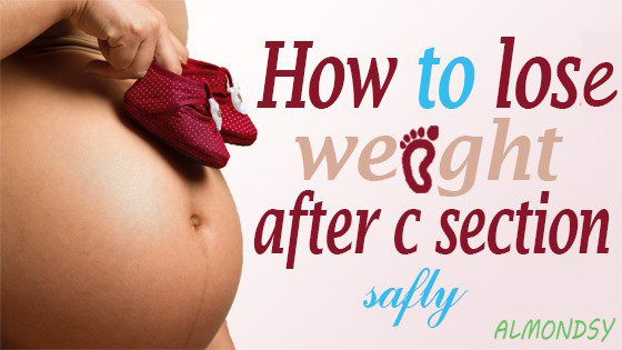 How To Lose Weight After C Section
 How To Lose Weight After C Section Safely Almondsy