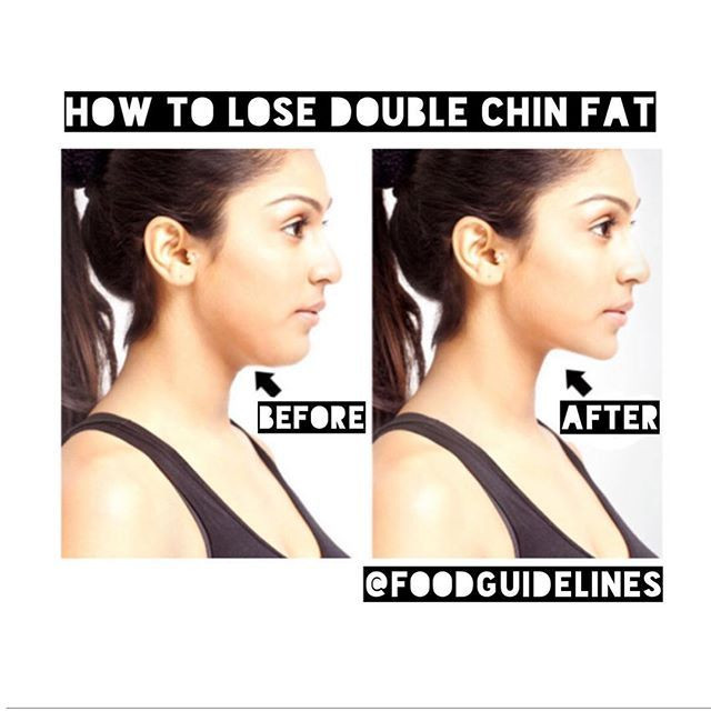 How To Lose Weight In Your Face Double Chin
 1 Lose weight e of the best ways to lose double chin