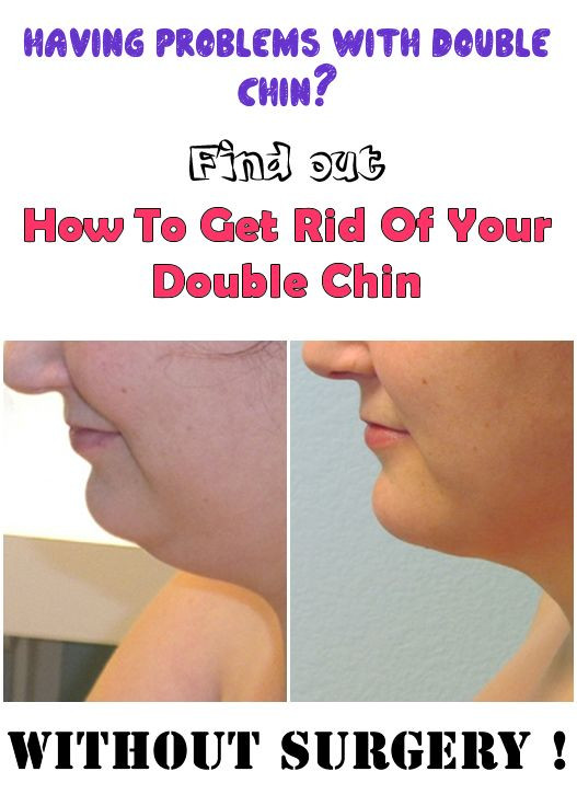How To Lose Weight In Your Face Double Chin
 Pin on info to know
