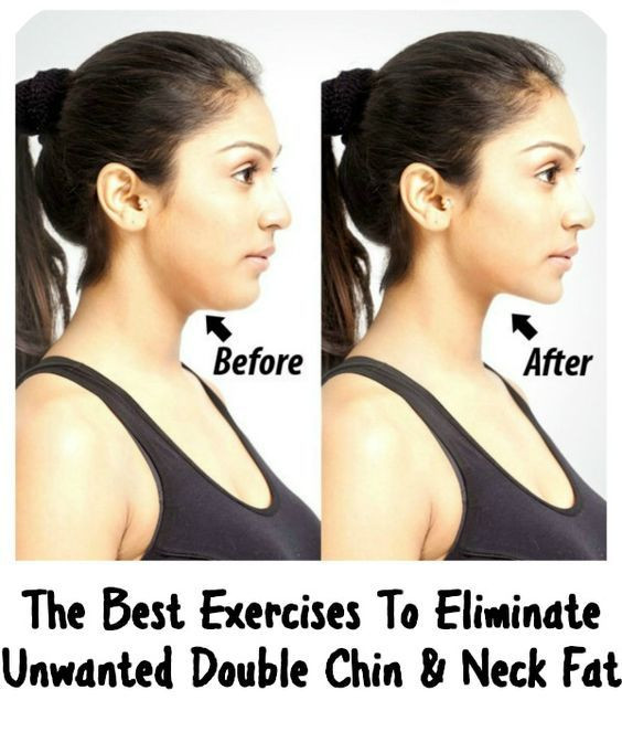 How To Lose Weight In Your Face Double Chin
 Pin on workout