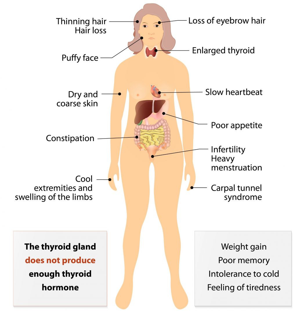 How To Lose Weight With Hypothyroidism
 Post Partum Thyroiditis Explained Lose Baby Weight