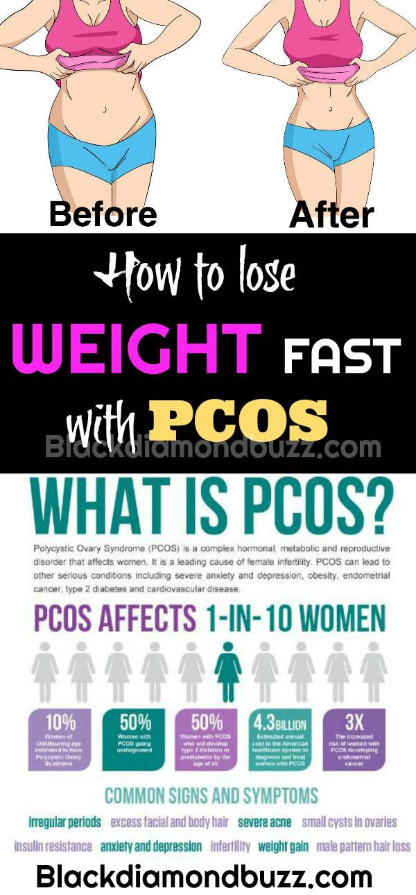 How To Lose Weight With Pcos
 How to Lose Weight with PCOS and Insulin Resistance Naturally