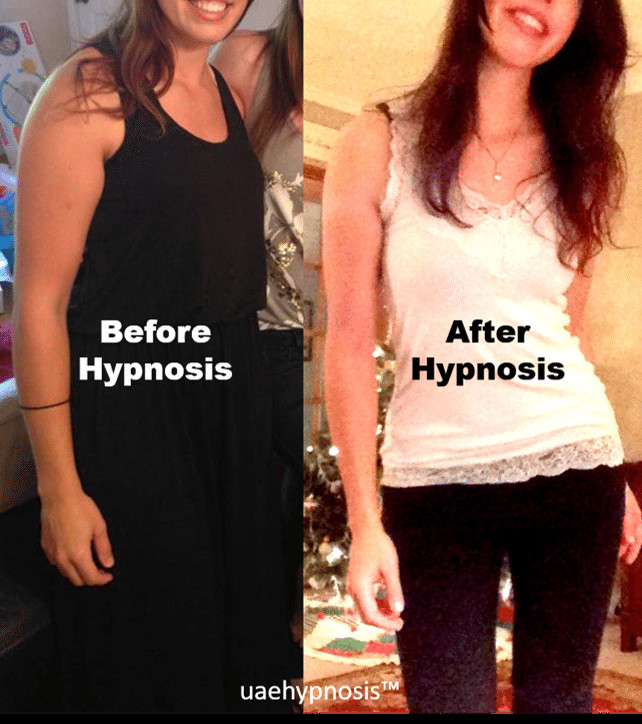 Hypnosis For Weight Loss
 Hypnosis for Weight Loss A Nurse s Journey with Hypnosis
