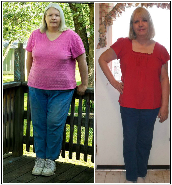 Low Carb Diet Results Before And After
 Inspiring Low Carb Success Story Meet Joyce…