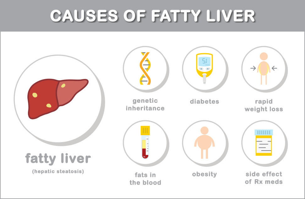Low Fat Diet For Fatty Liver
 Pin on Health Maintenance