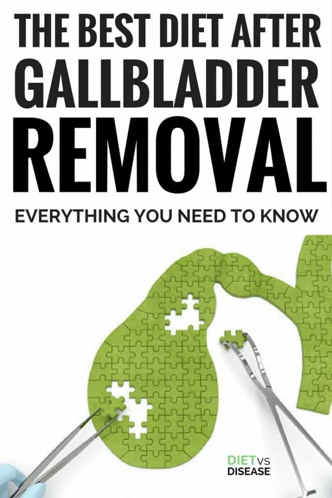 Low Fat Diet For Gallbladder Removal
 The Best Diet After Gallbladder Removal Everything You