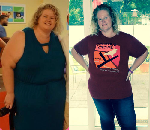 Plant Based Diet Before And After Success Story
 Herbie of the Week Amy B She s Lost Over 100lbs Followi
