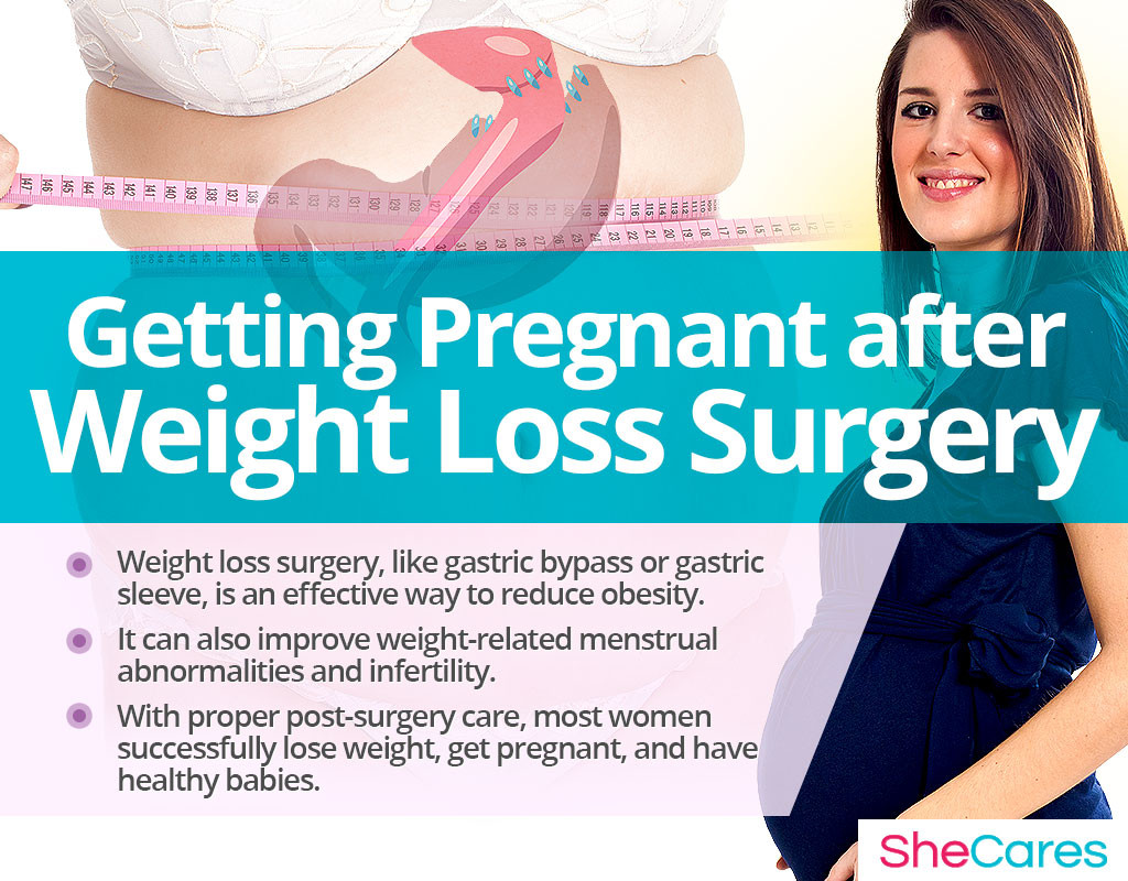 Pregnancy After Weight Loss Surgery
 Getting Pregnant after Weight Loss Surgery