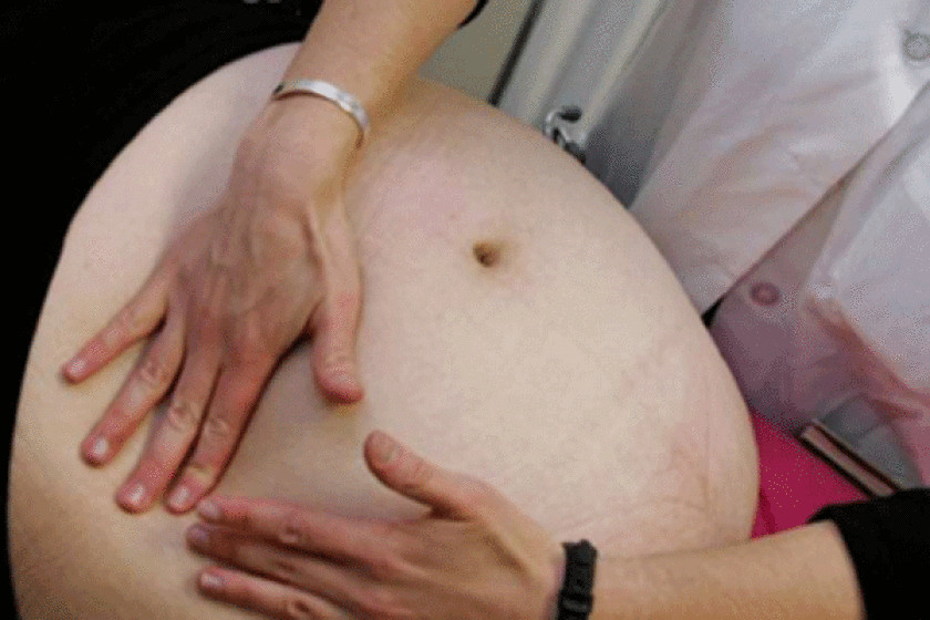 Pregnancy After Weight Loss Surgery
 Study Babies born after moms weight loss surgery are