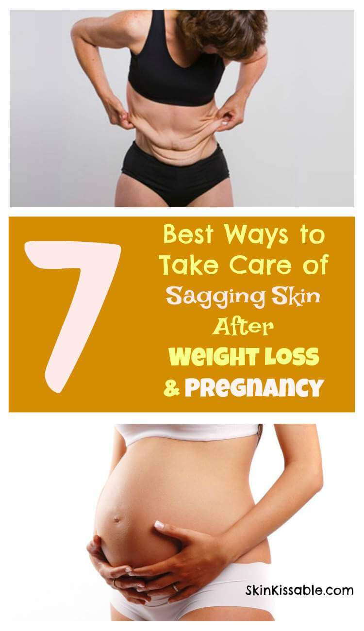Sagging Skin After Weight Loss Exercise
 What Is Ultherapy Treatment and Does it Work Side Effects