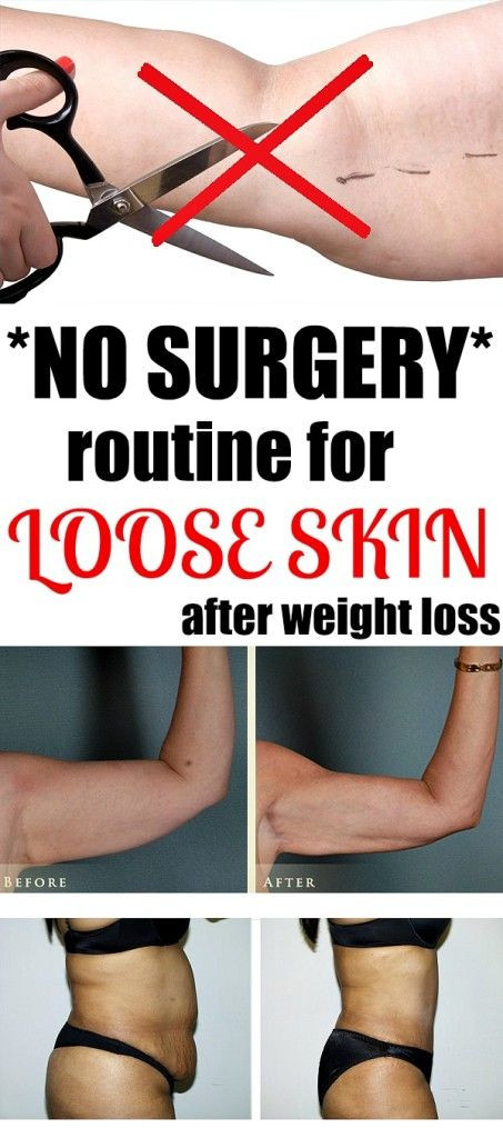 Sagging Skin After Weight Loss Exercise
 17 Best images about Diet on Pinterest