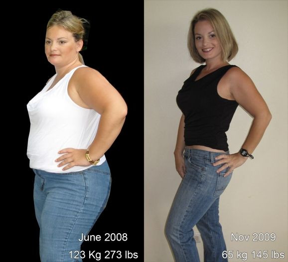 Vsg Before And After Sleeve Weight Loss Surgery
 32 best WLS Before & After images on Pinterest