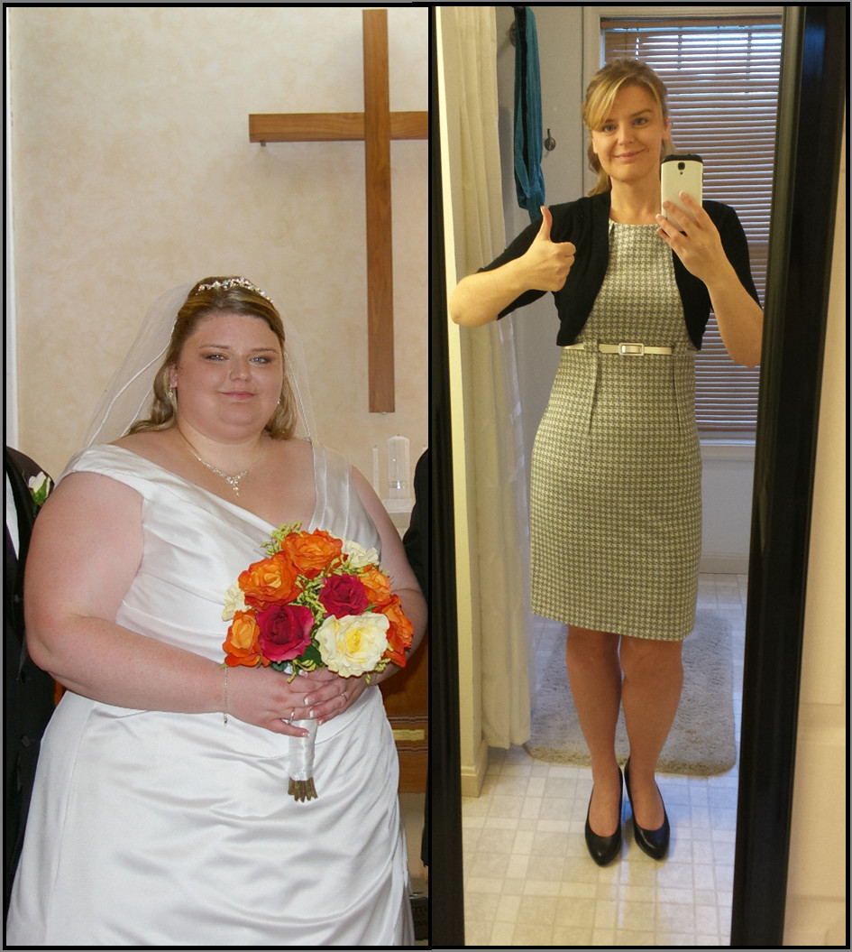 Vsg Before And After Sleeve Weight Loss Surgery
 Flirty by Thirty