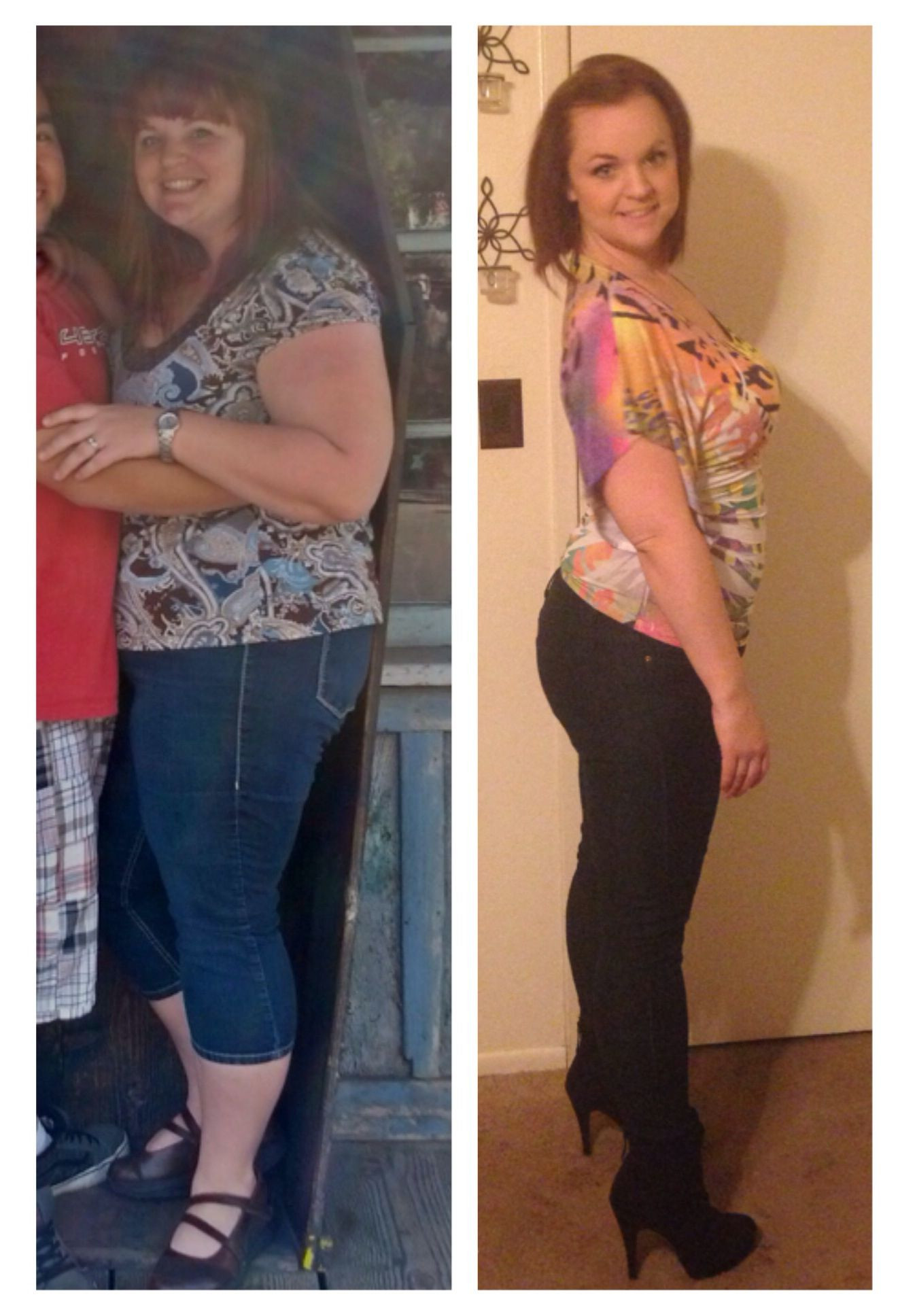 Vsg Before And After Sleeve Weight Loss Surgery
 Pin by Frenchie on Before and after gastric sleeve