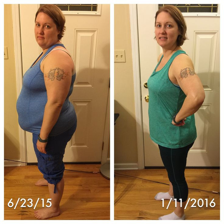 Vsg Before And After Sleeve Weight Loss Surgery
 Before and After stats and pictures