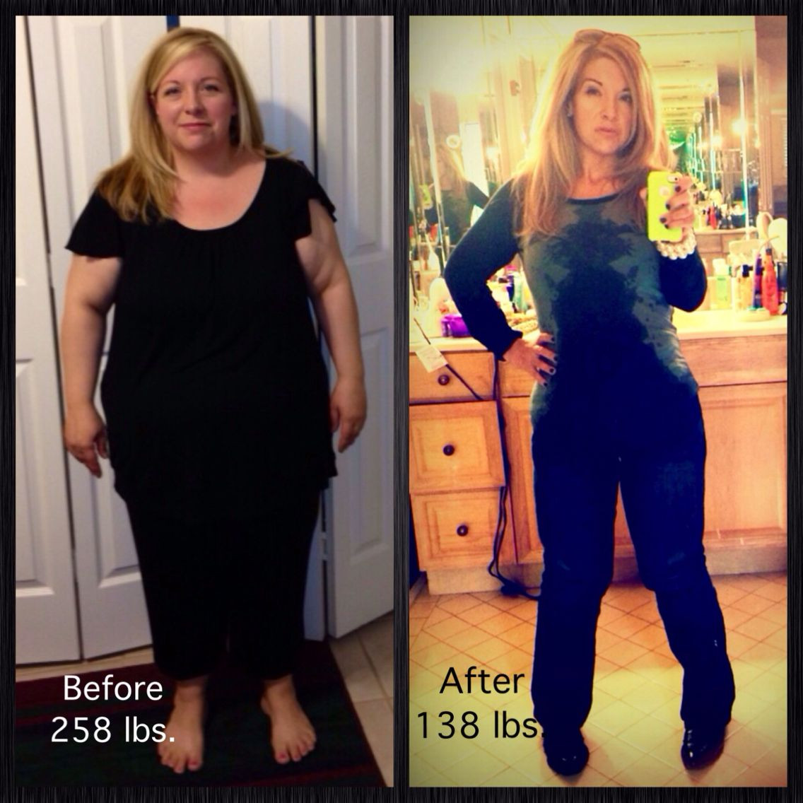 Vsg Before And After Sleeve Weight Loss Surgery
 Pin on health