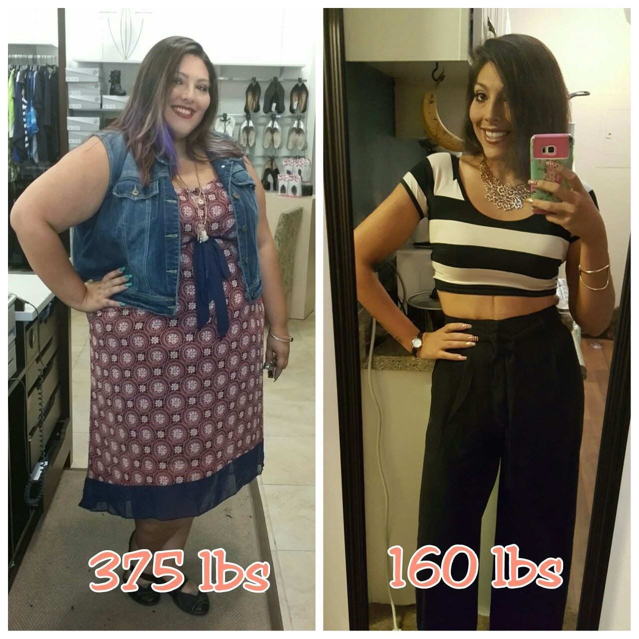 Vsg Before And After Sleeve Weight Loss Surgery
 Pin on Before & After Makeovers
