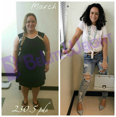 Vsg Before And After Sleeve Weight Loss Surgery
 Testimonials