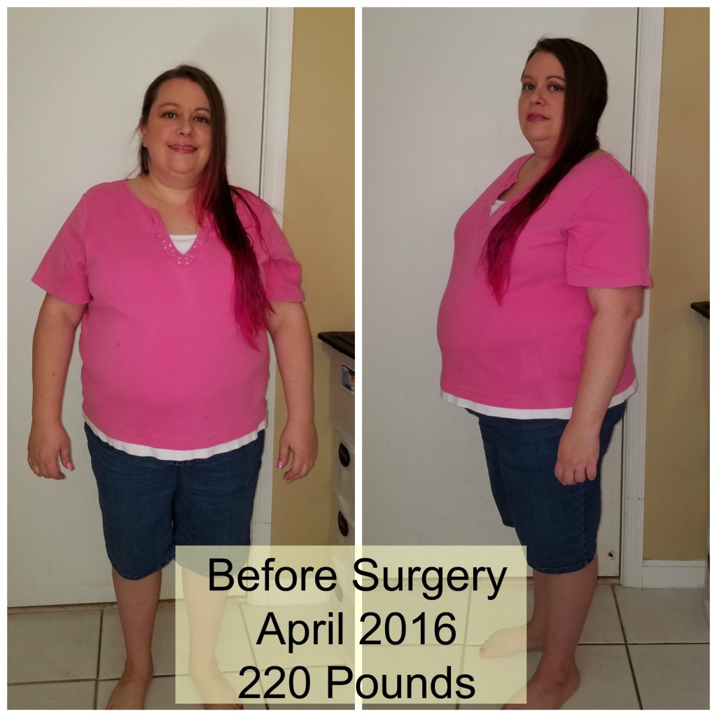 Weight Loss Surgery Before And After
 My Road to Gastric Sleeve Weight Loss Surgery Cori s