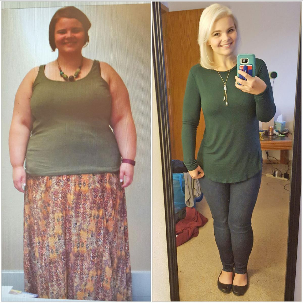 Weight Loss Surgery Before And After Pictures
 Eden Prairie grad has large Instagram following after